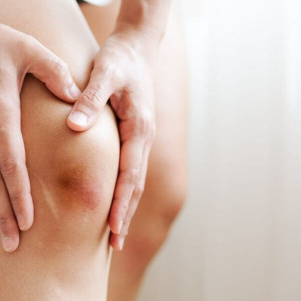 ปวดเข่าห้ามกินอะไร, อาหารเสริมบำรุงกระดูก