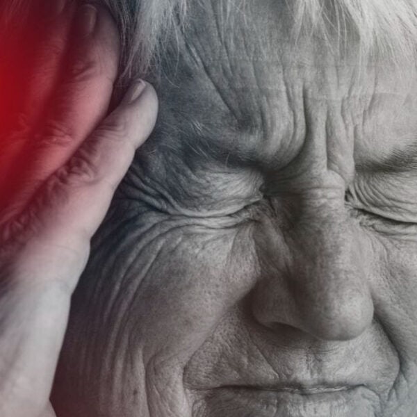 โรคหลอดเลือดสมอง สาเหตุ, โรค stroke