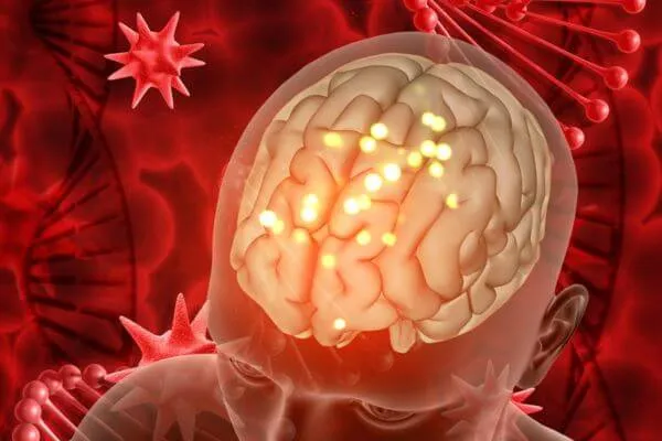 โรคสมองอักเสบ, โรคสมองอักเสบจากภูมิคุ้มกัน